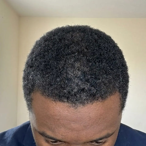 Hair after using Medíté