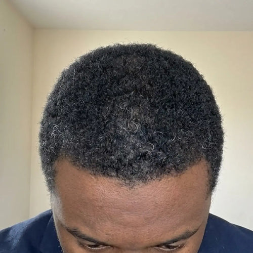 After photo of a man showing a fuller hairline, thicker-looking hair, improved scalp coverage, and visible hair growth results following a consistent hair regrowth routine.