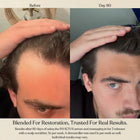 Before and day 90 comparison photos of a man's scalp showing hair growth results, with text at the bottom reading 'Blended For Restoration, Trusted For Real Results.' and product usage details.
