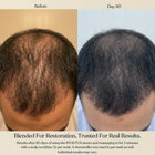 Before and day 90 comparison of a man's thinning hair on the crown of his head, showing hair growth results. Text at the bottom mentions Invictus serum and scalp massage.