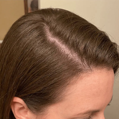 After photo showing visibly thicker, fuller hair following consistent use of Medité plant-based hair growth oil for men and women